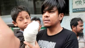 কুড়িয়া পাওয়া বোতল বিস্ফোরণ, গুরুতর আহত শিশু